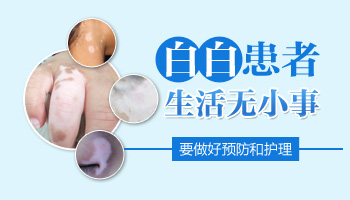 白癜风症状传染么